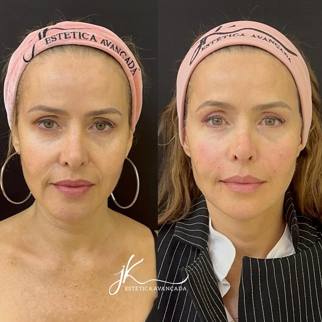 Post 9 by Dr. Pablo Rodrigues | Estética e Rejuvenescimento Facial on Instagram (image)