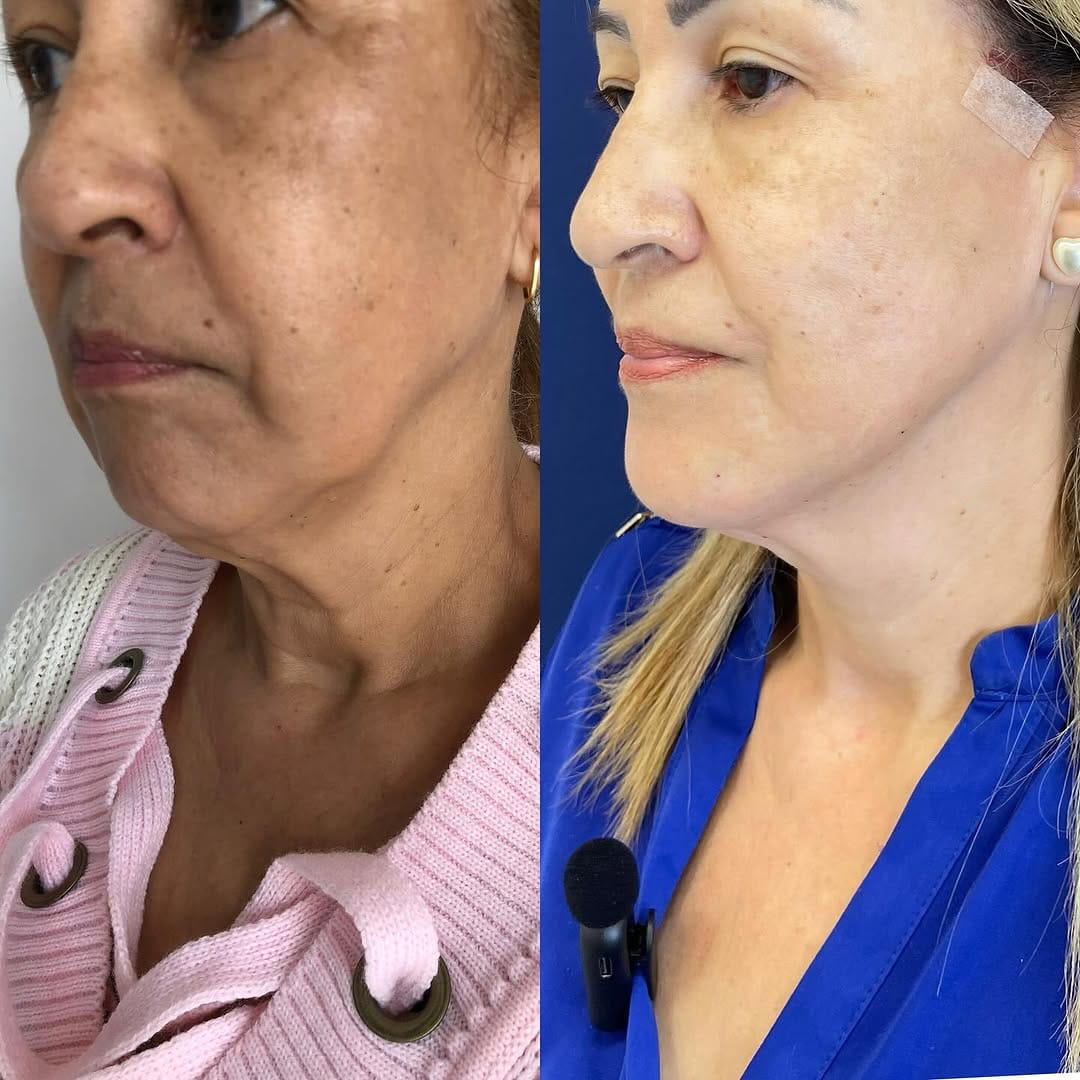 Post 9 by Dra. Lary Venturelli | Fios de Sustentação on Instagram (carousel)