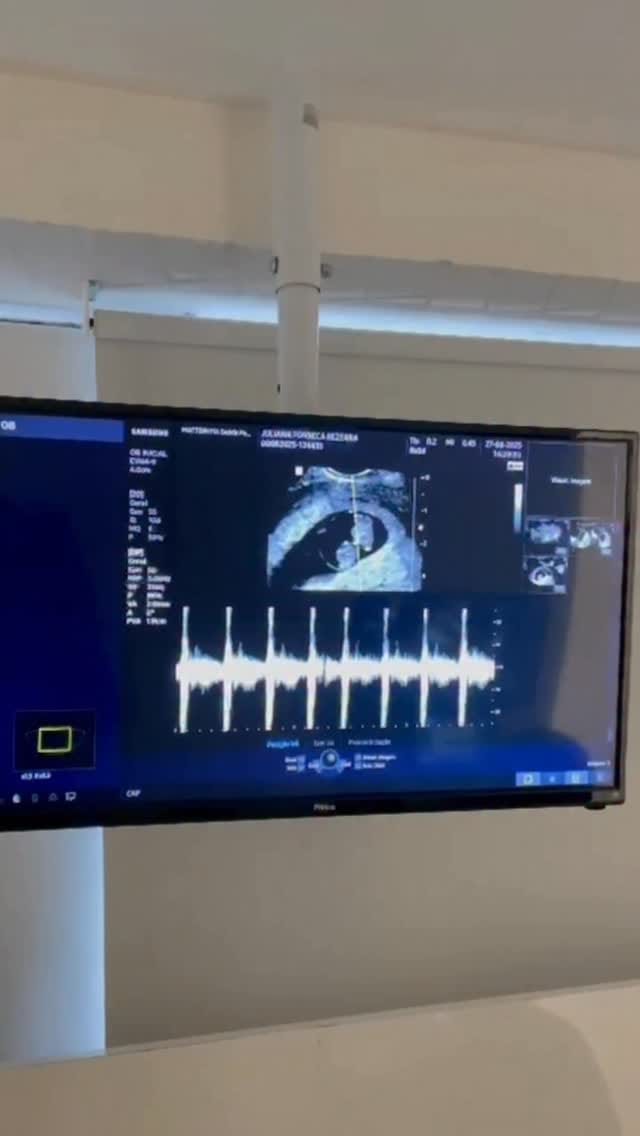 Post 10 by Juliana Bezerra - Fertilidade e Gestação on Instagram (video)