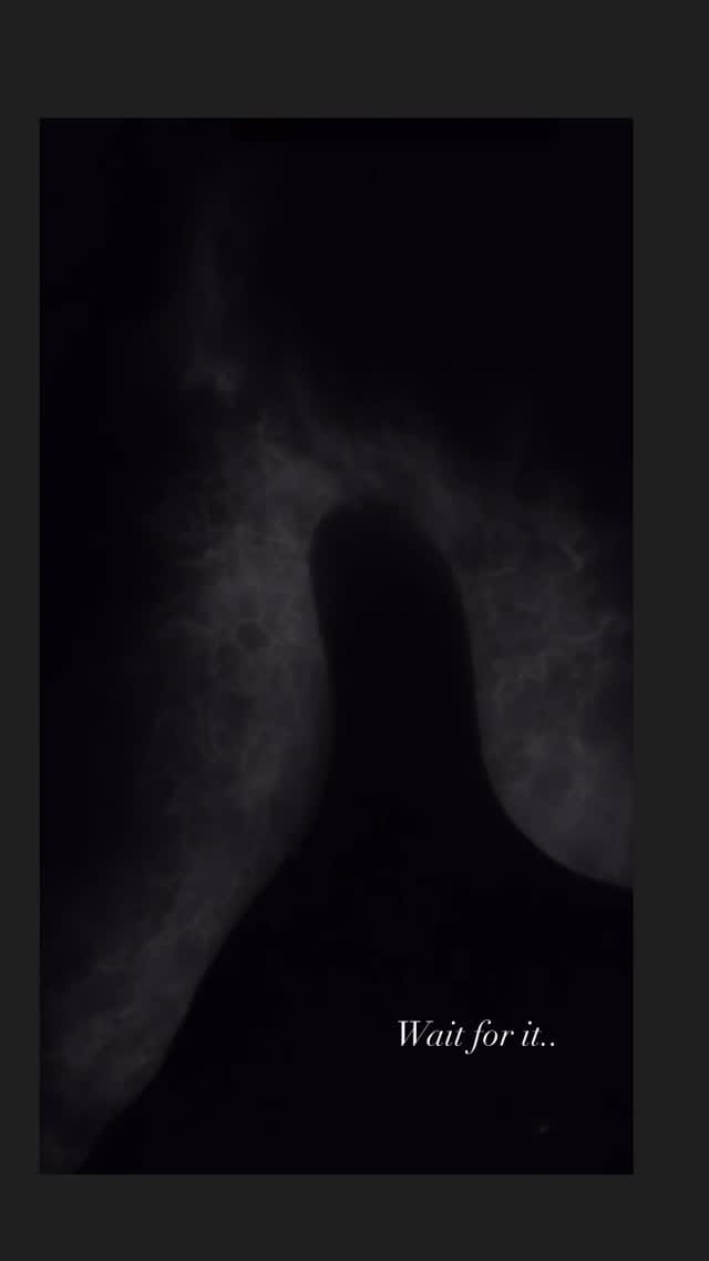 Post 1 by Katerina G.K.~ Curator of the female body/ Wellness Pro on Instagram (video)
