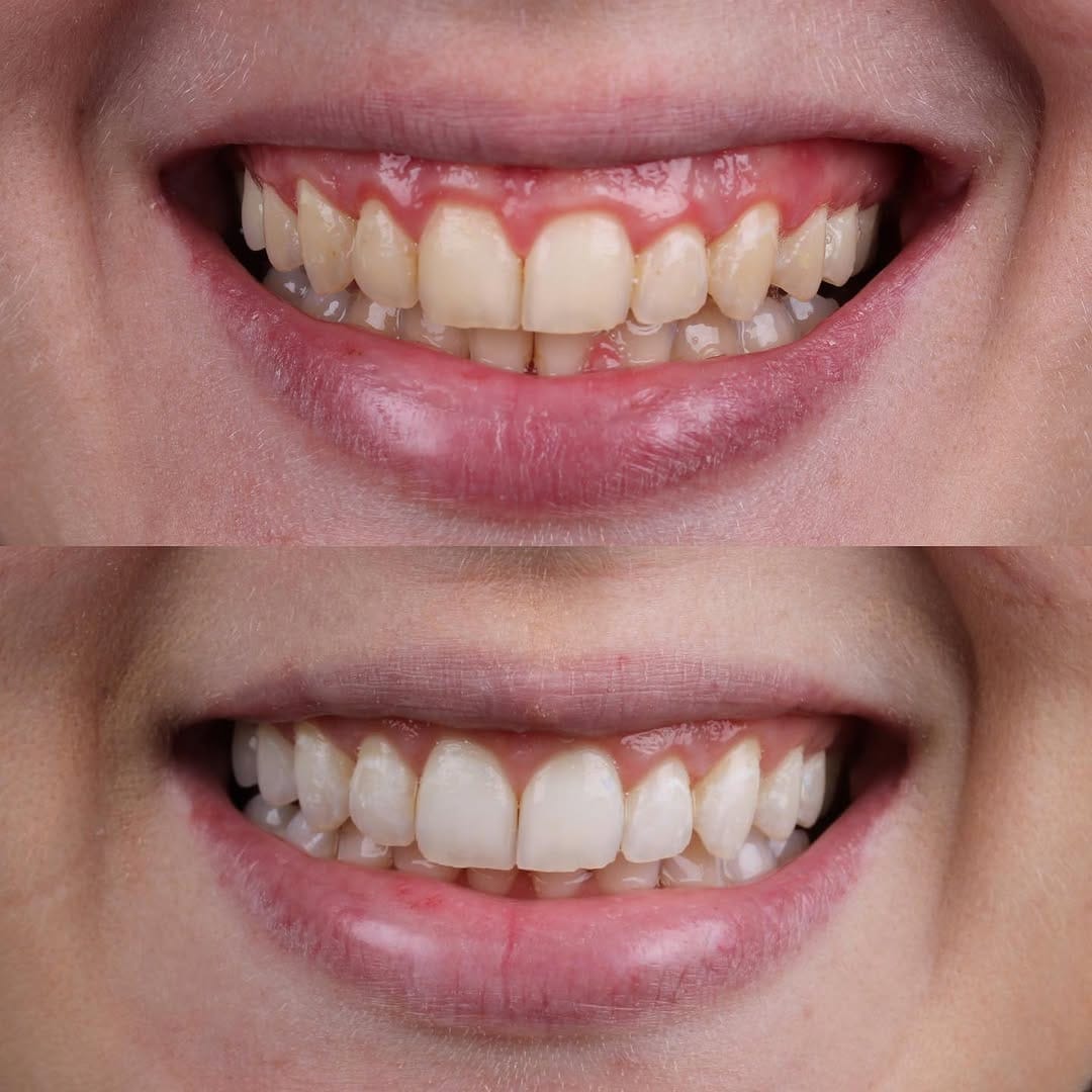 Post 10 by Larissa Luduvice | Dentista em Aracaju on Instagram (image)