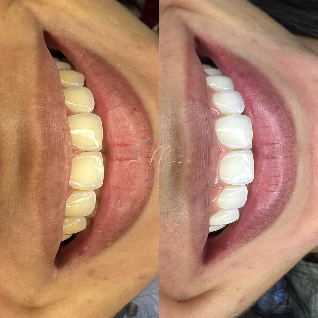 Post 9 by Larissa Luduvice | Dentista em Aracaju on Instagram (image)