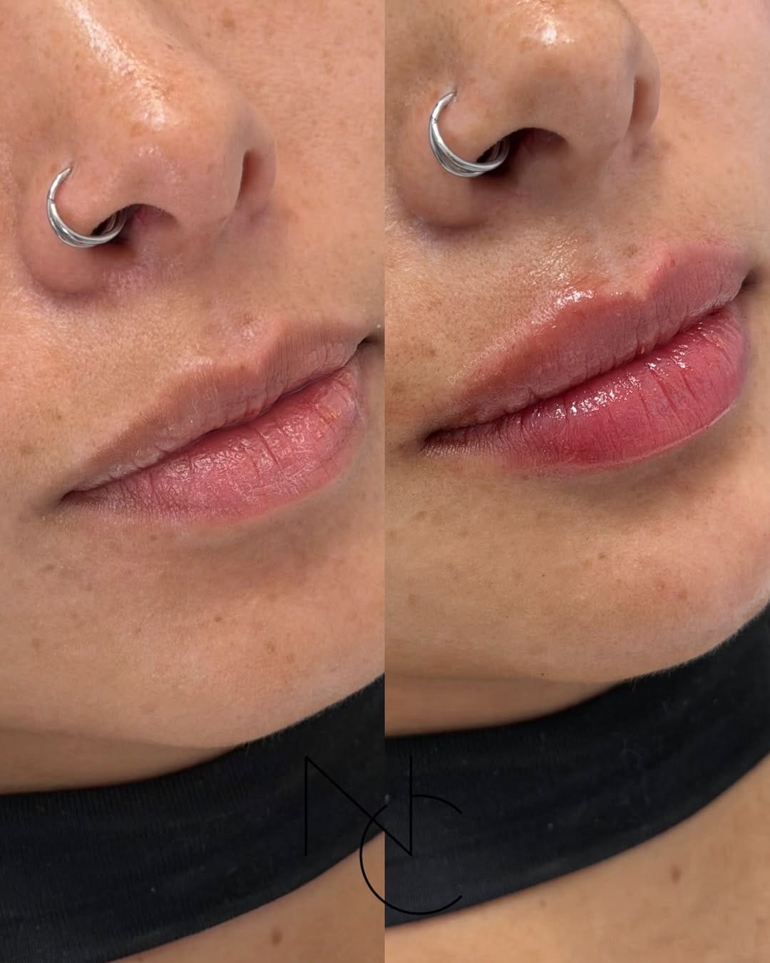 Post 2 by Dra. Naeomi Chacón on Instagram (image)