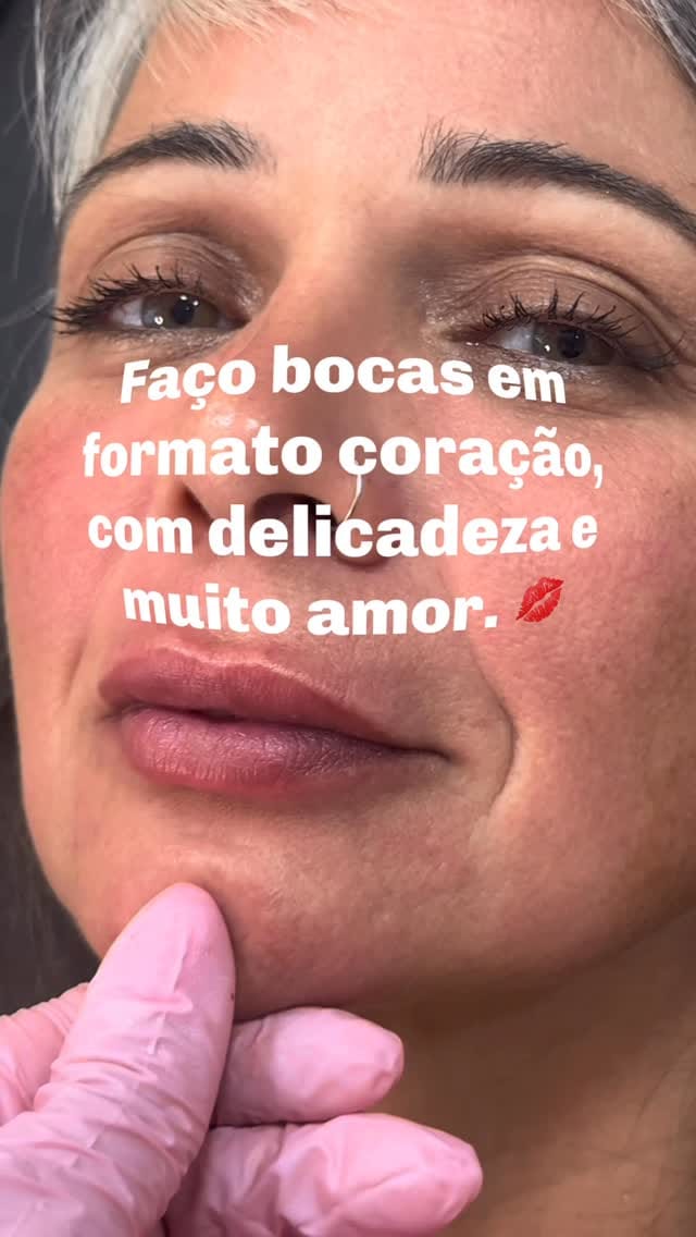 Post 3 by Dra. Gisele Santos  II Botox em Santos on Instagram (video)