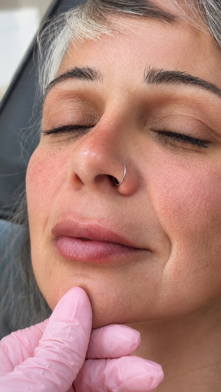 Post 8 by Dra. Gisele Santos  II Botox em Santos on Instagram (video)