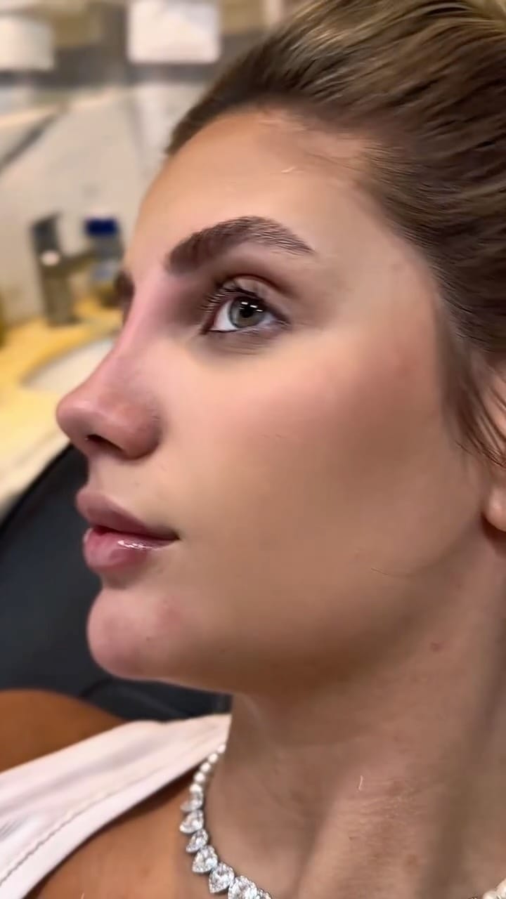 Post 10 by Dra. Gisele Santos  II Botox em Santos on Instagram (video)