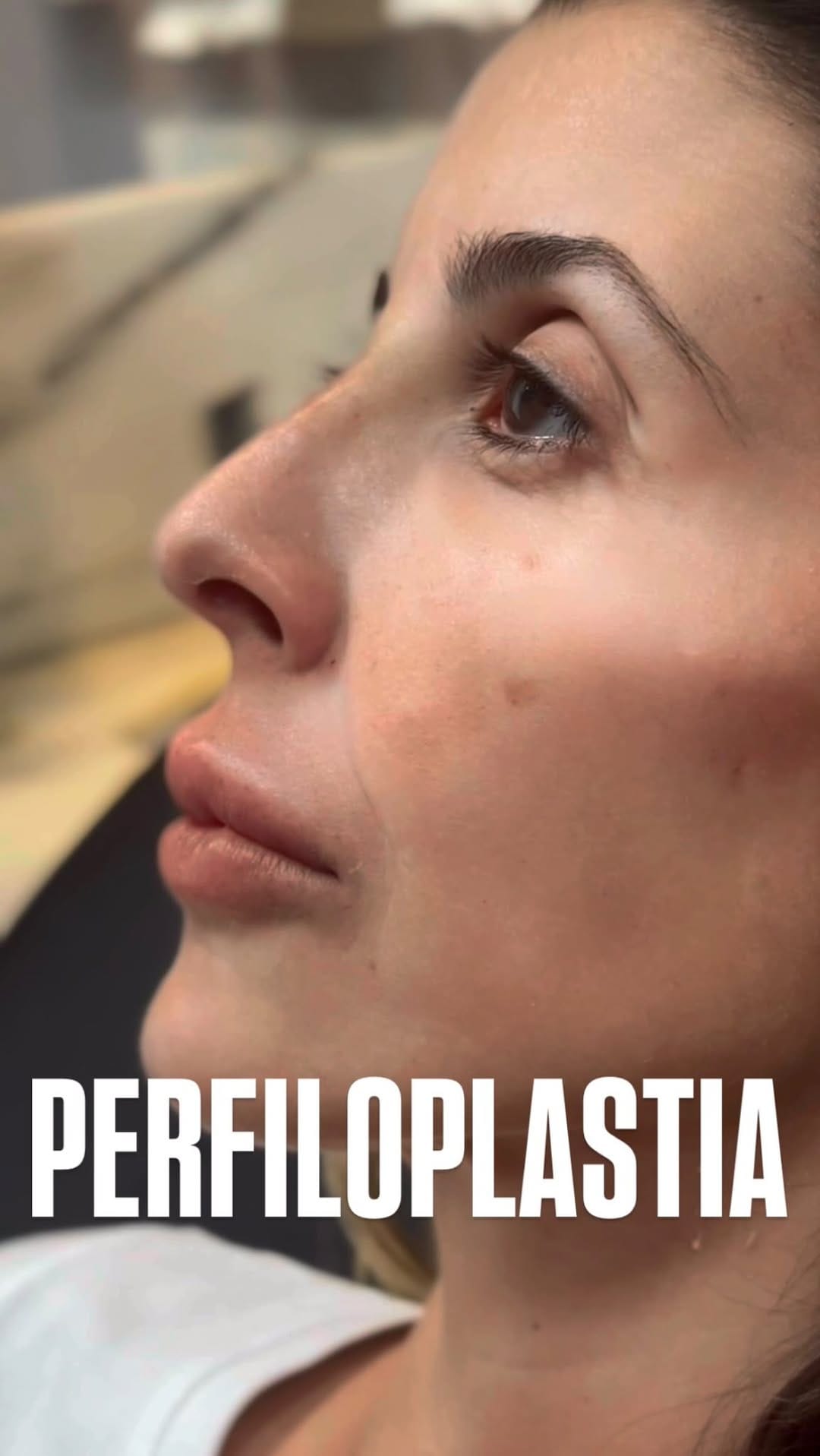 Post 5 by Dra. Gisele Santos  II Botox em Santos on Instagram (video)