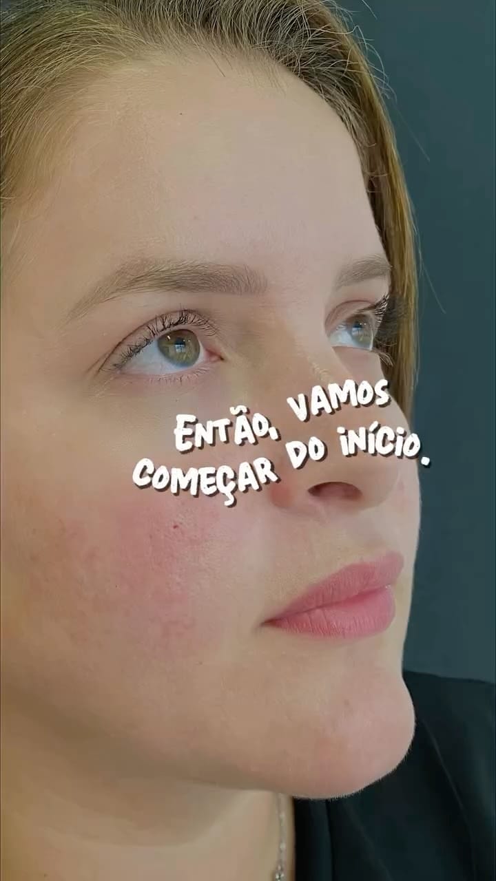 Post 10 by Dra. Thássia Marçal | Harmonização Facial | CRBM-12091 on Instagram (video)