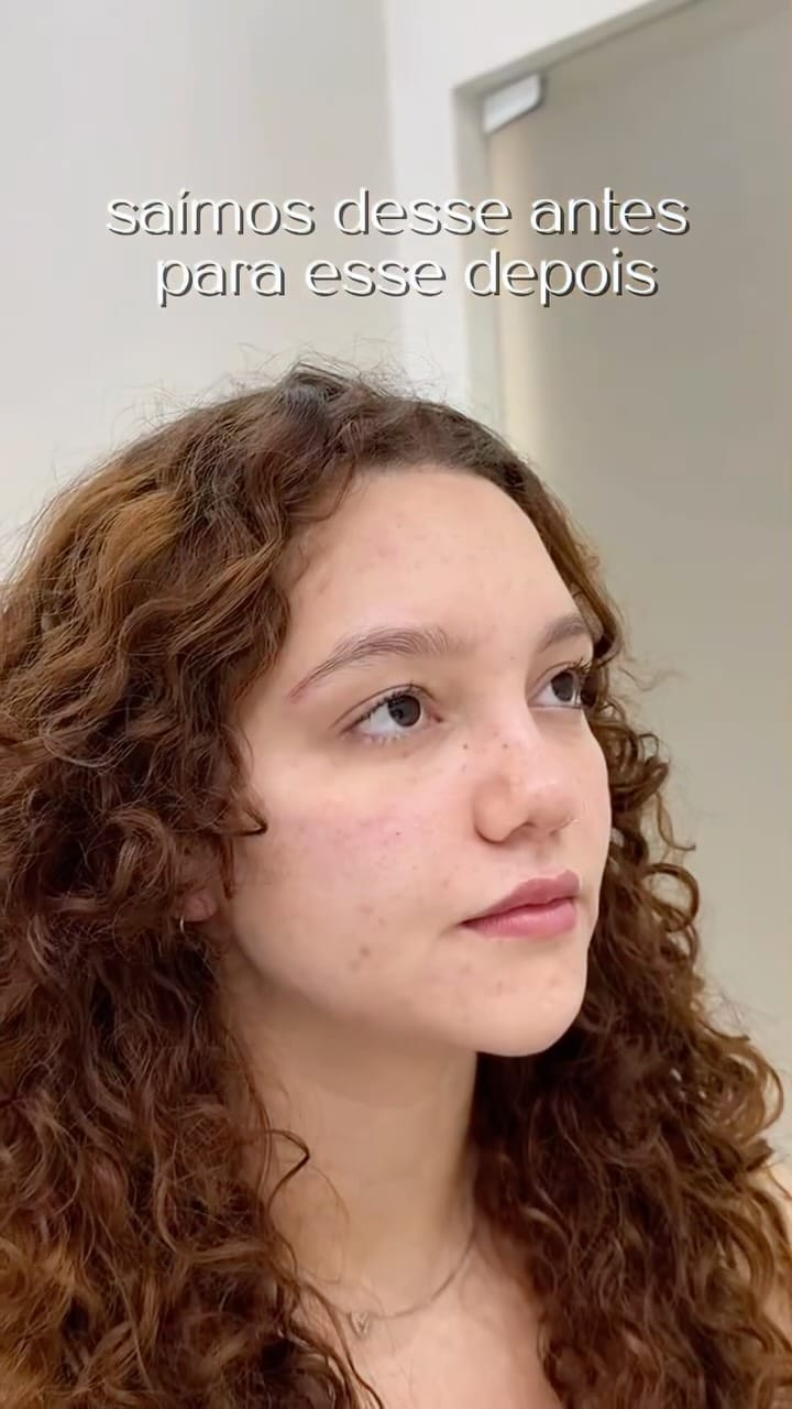 Post 9 by Dra. Thássia Marçal | Harmonização Facial | CRBM-12091 on Instagram (video)