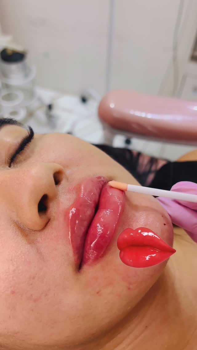 Post 1 by Dra Mirian campos on Instagram (video)