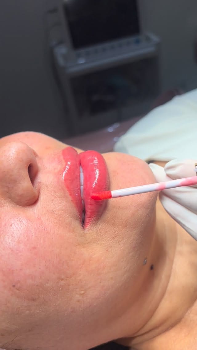 Post 4 by Dra Mirian campos on Instagram (video)