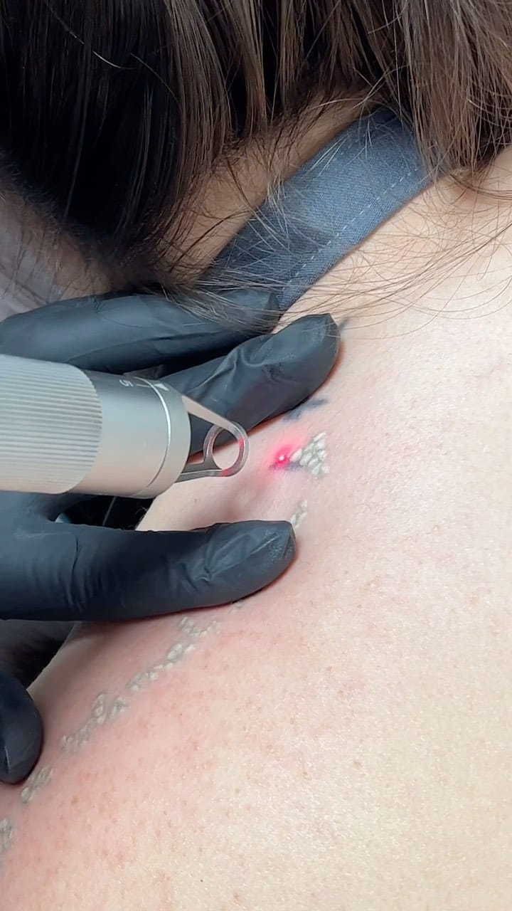 Post 9 by KARINE DONATO / SOBRANCELHAS E CÍLIOS CASCAVEL PR on Instagram (video)