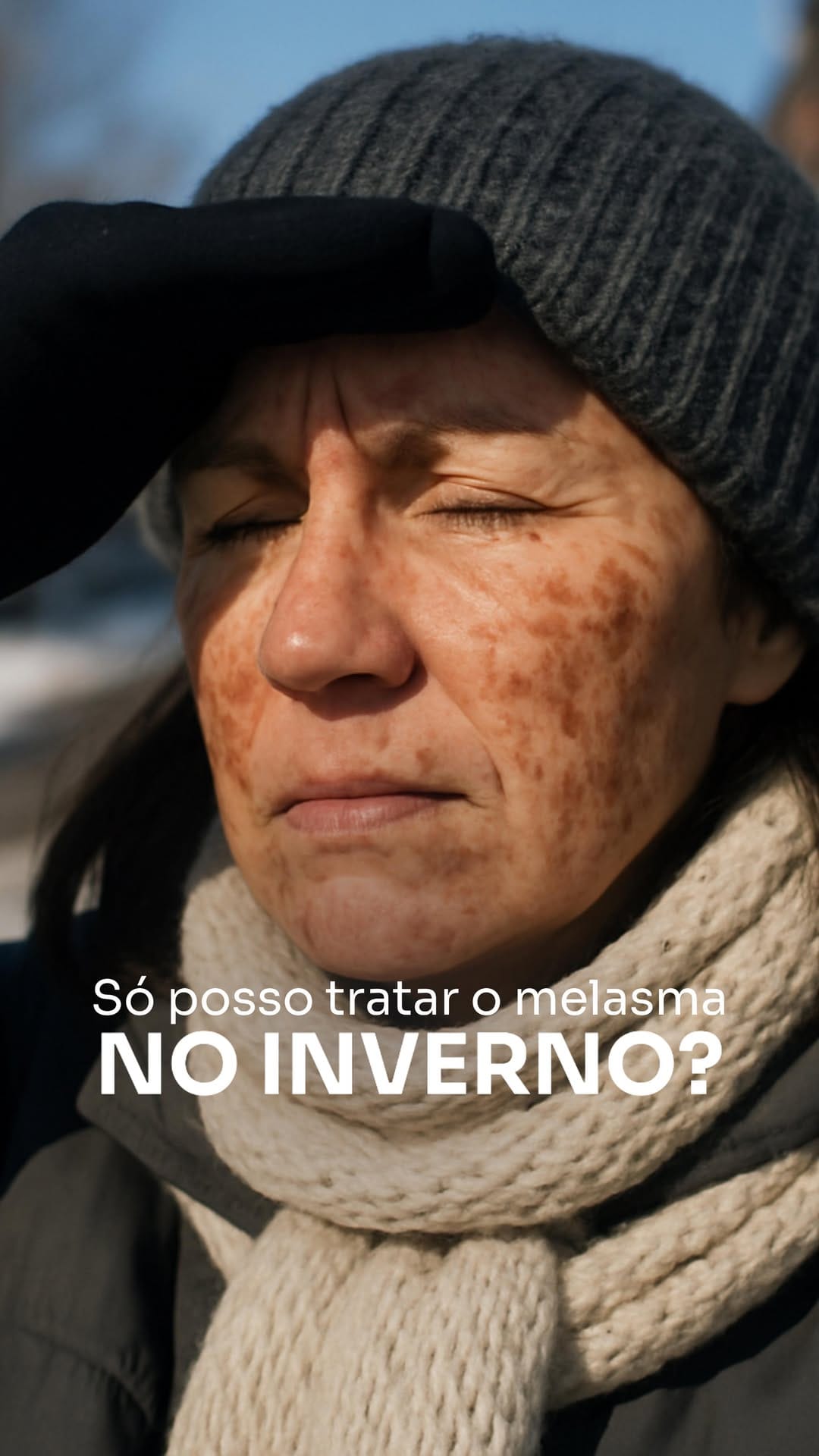 Post 1 by Invisible Melasma By Agnes Christie on Instagram (video)
