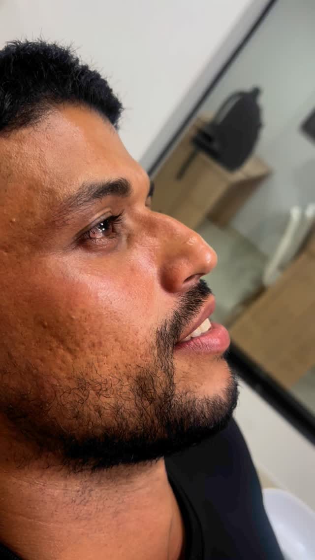 Post 8 by Instituto Faissal Campinas SP| Harmonização facial on Instagram (video)