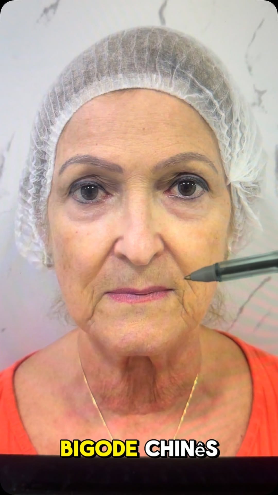 Post 4 by Instituto Faissal Campinas SP| Harmonização facial on Instagram (video)
