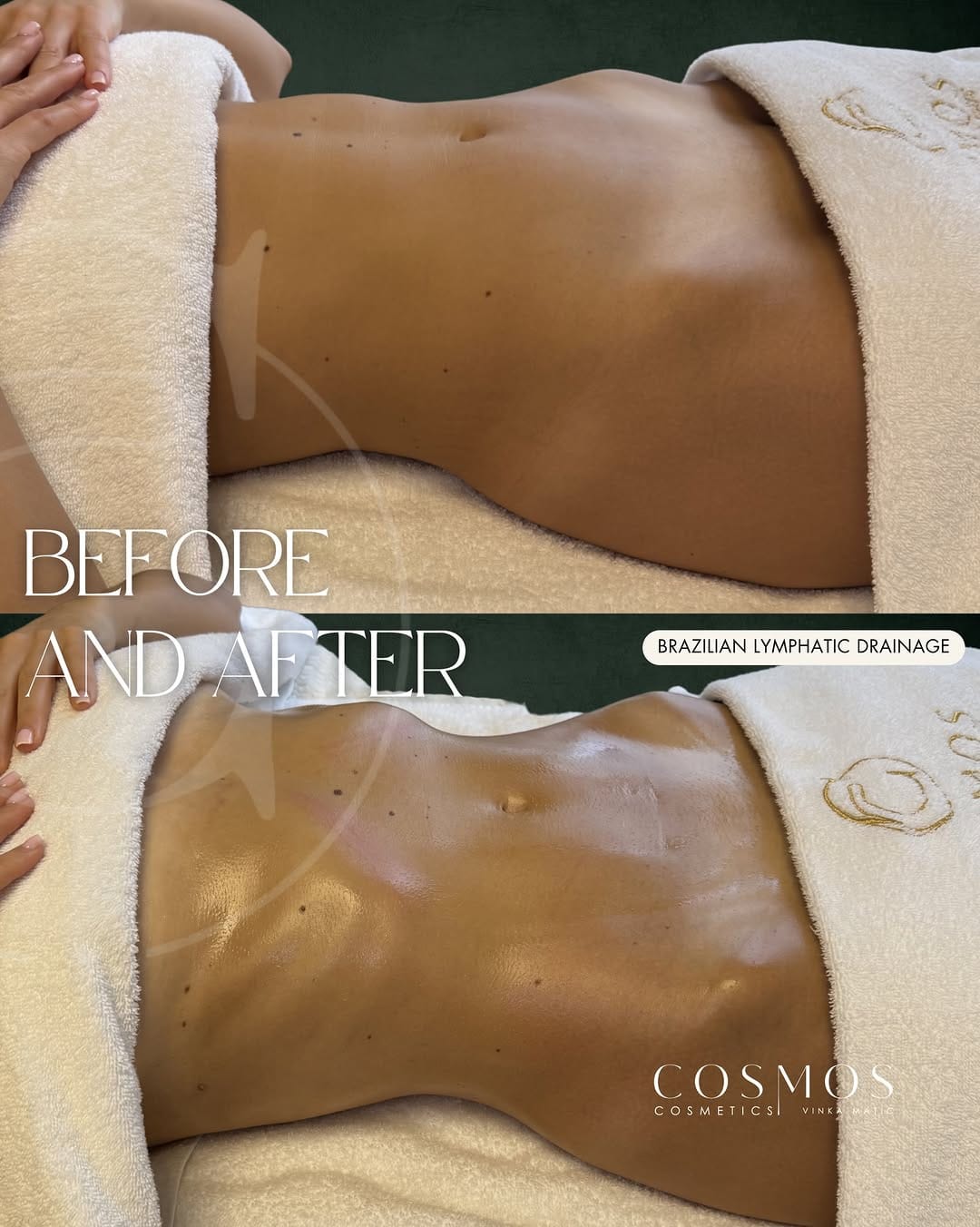 Post 2 by Vinka M. Brasilianische Lymphdrainage & Schulungen on Instagram (image)