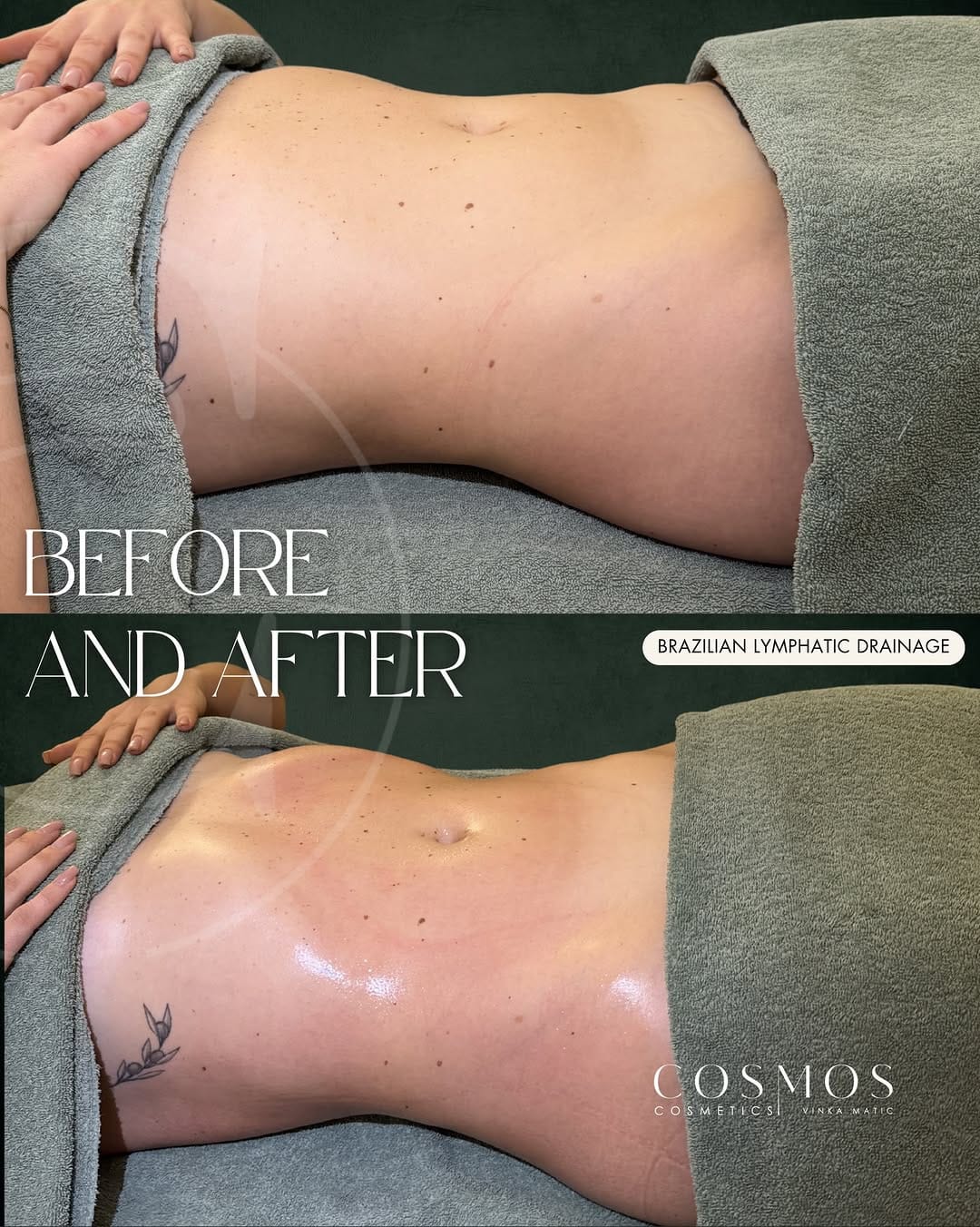 Post 5 by Vinka M. Brasilianische Lymphdrainage & Schulungen on Instagram (image)