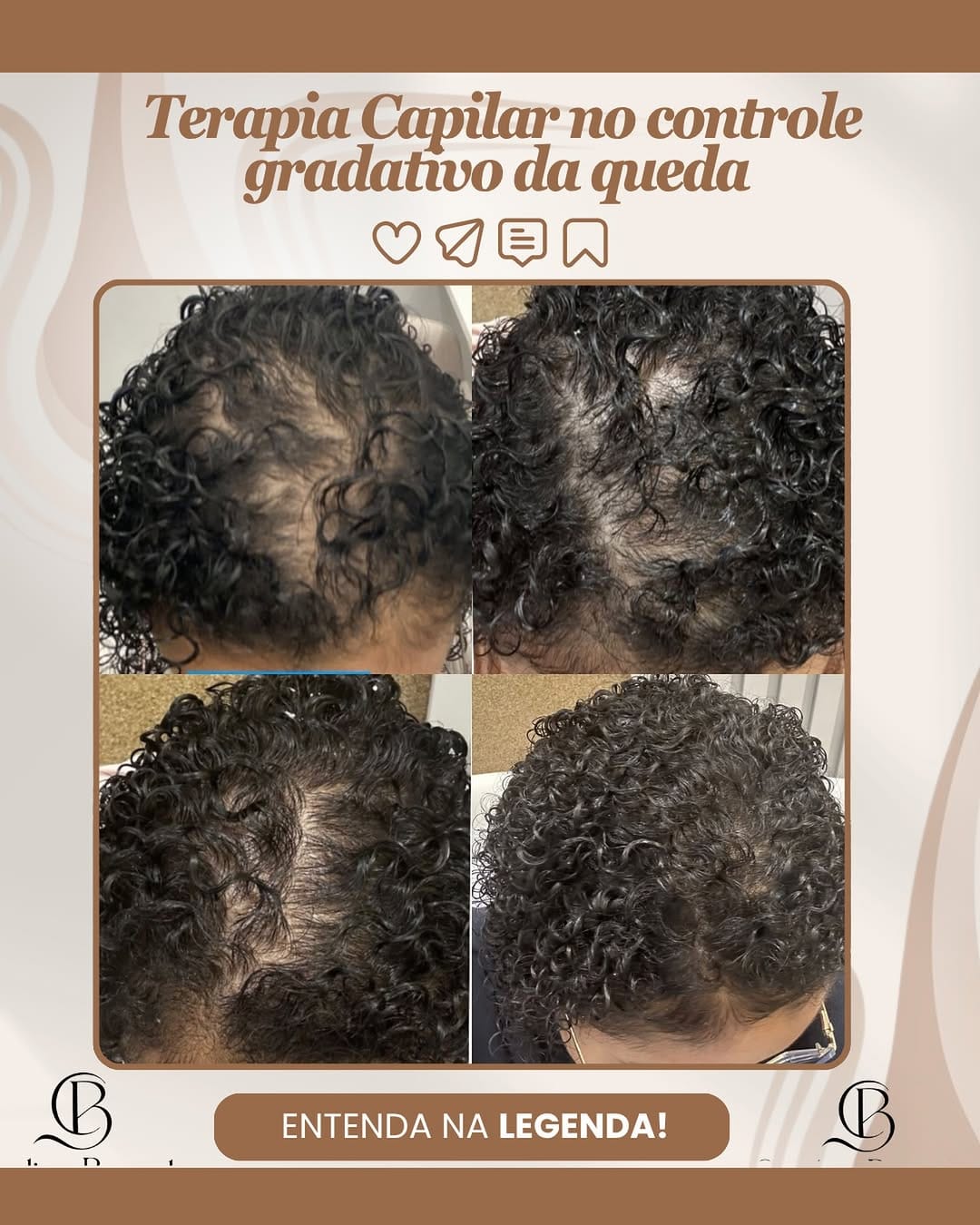 Post 2 by Ana Carolina Bazante Pessoa - Colorista e Terapeuta Capilar on Instagram (image)