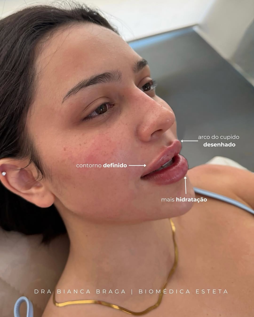 Post 2 by Bianca Braga | Biomédica Esteta on Instagram (image)