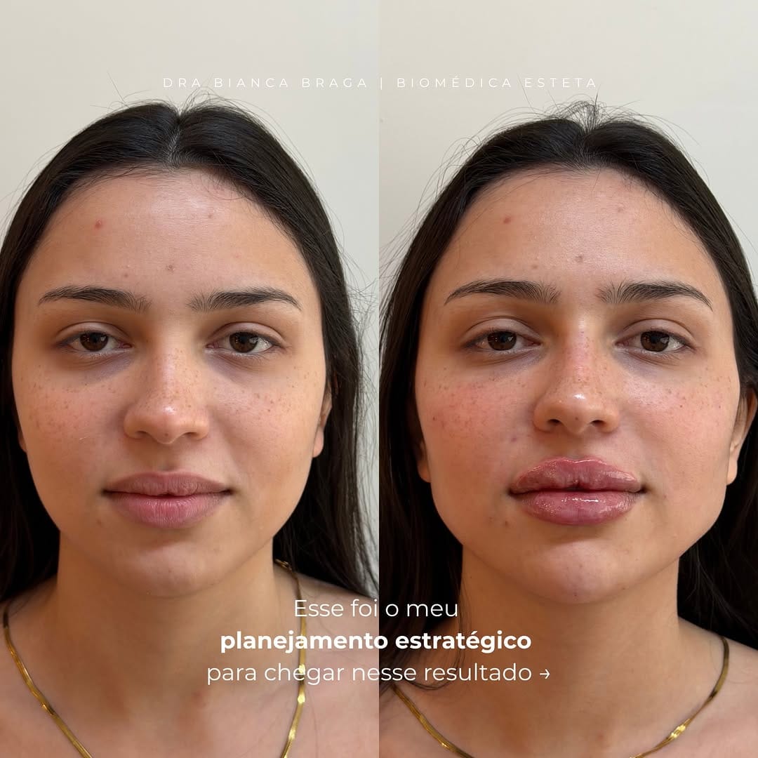 Post 4 by Bianca Braga | Biomédica Esteta on Instagram (carousel)