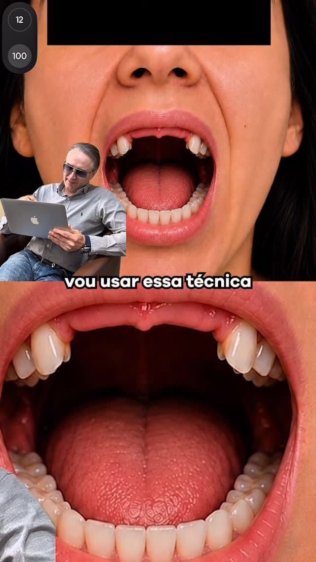 Post 5 by DenteBelo Dentistas on Instagram (video)