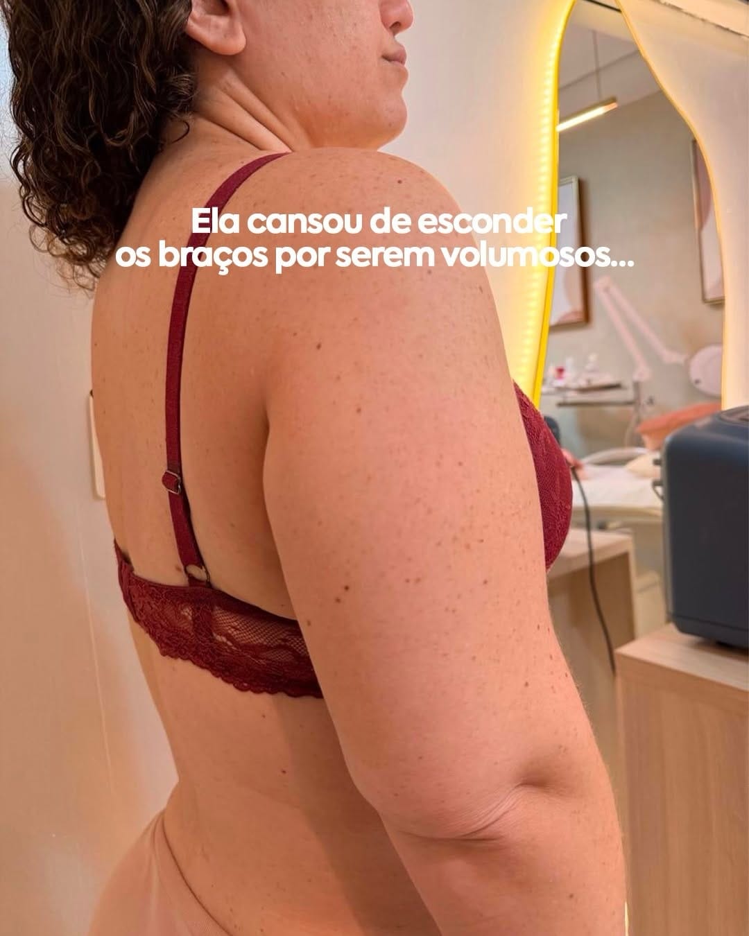 Post 4 by Dra. Darcyanne Guedes | Estética Avançada on Instagram (carousel)