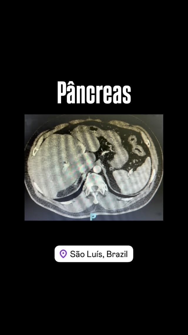 Post 2 by Dr. Orlando Torres on Instagram (video)