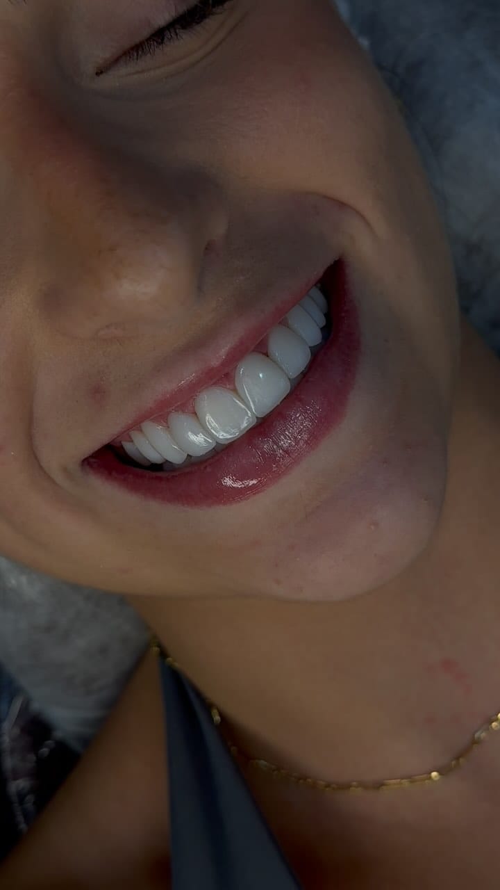 Post 8 by Dra. Cybele Queiroz | Odontologia Estética | Harmonização Facial on Instagram (video)