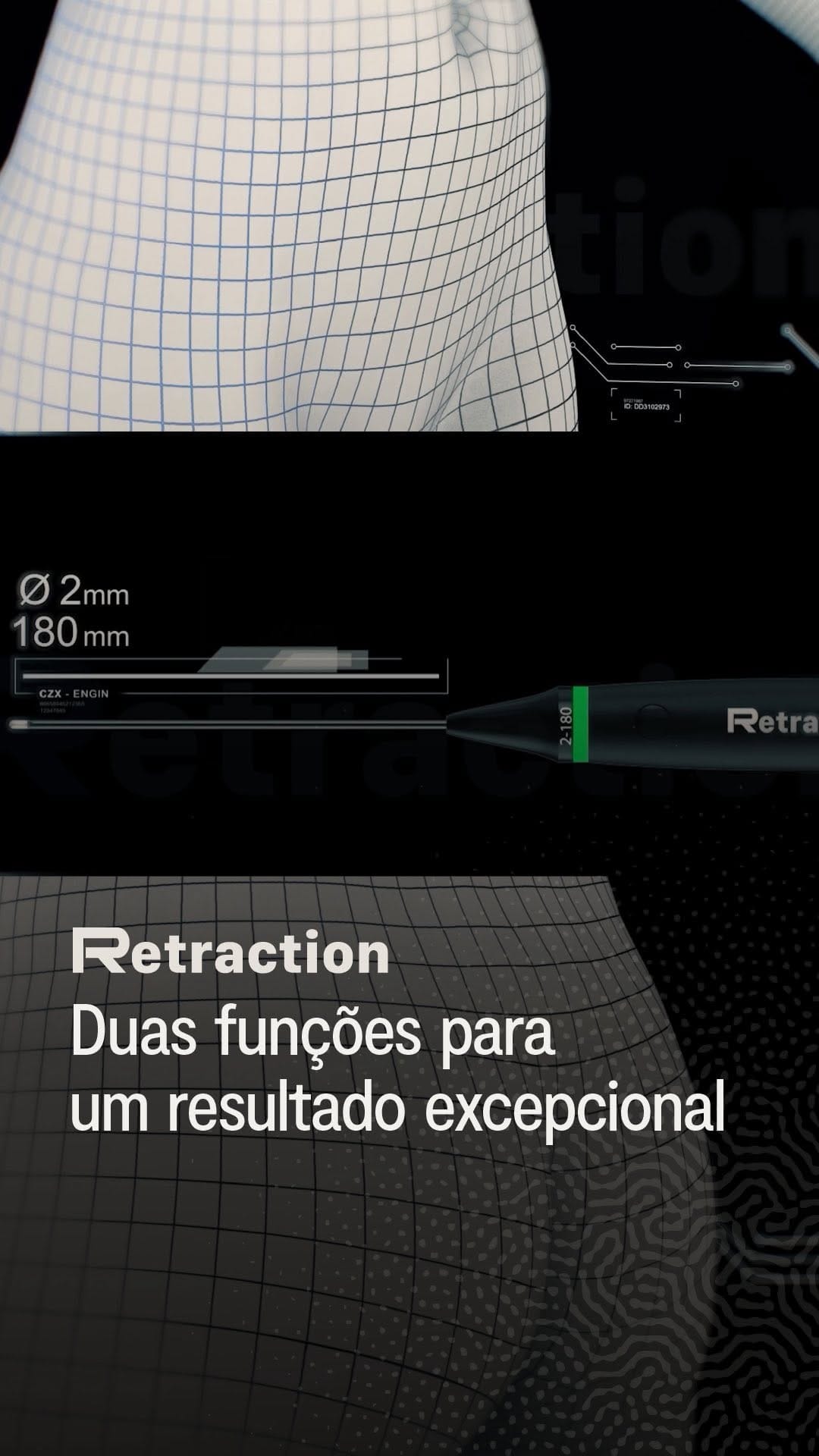 Post 5 by Dr. Eduardo Gusmão on Instagram (video)