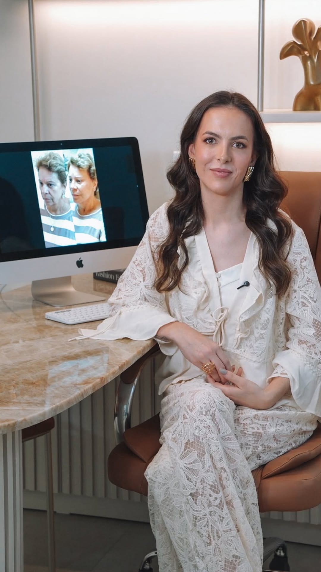 Post 1 by Larissa Nairni - Harmonização Facial on Instagram (video)