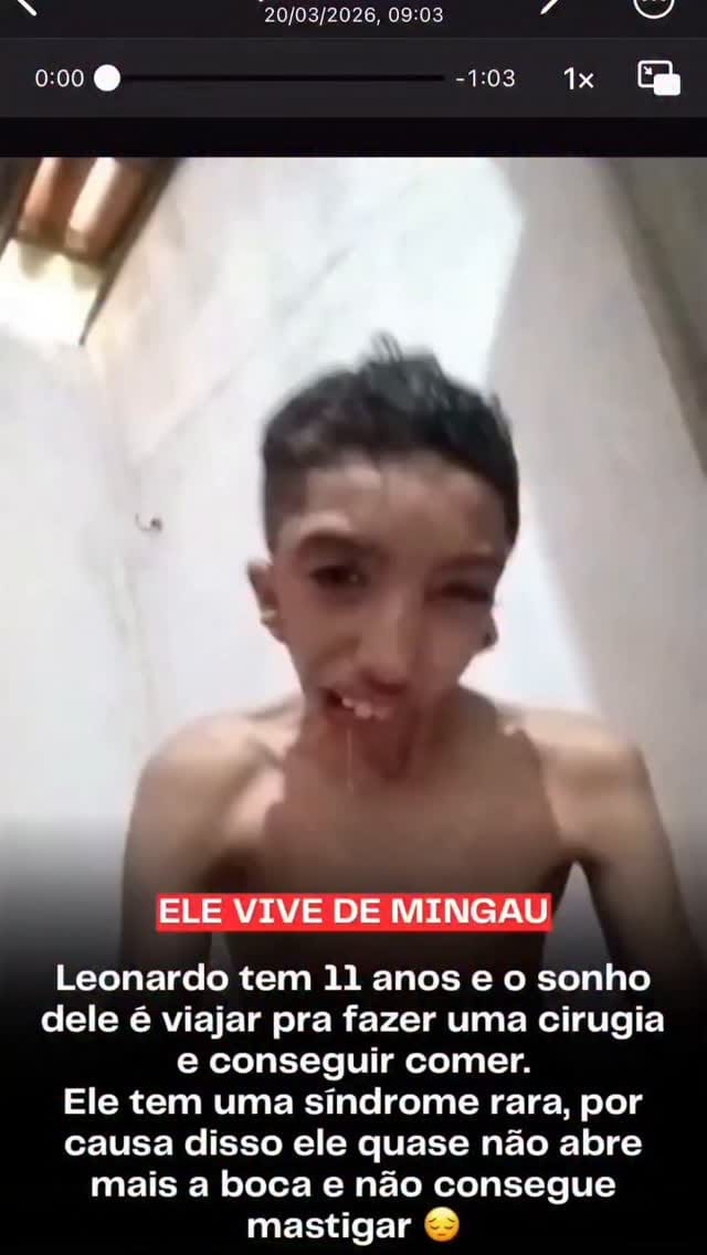 Post 2 by Dr. Luis Gustavo Paiva | Cirurgião Bucomaxilofacial em Goiânia on Instagram (video)