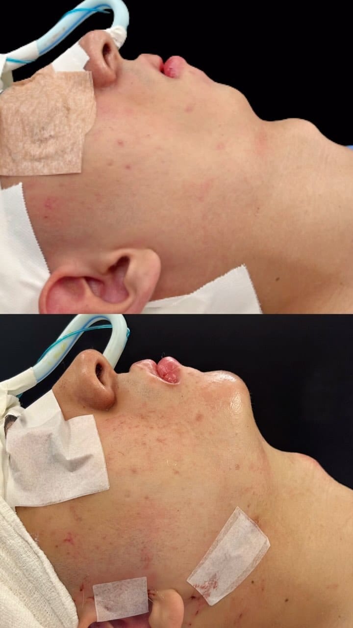 Post 10 by Dr. Luis Gustavo Paiva | Cirurgião Bucomaxilofacial em Goiânia on Instagram (video)