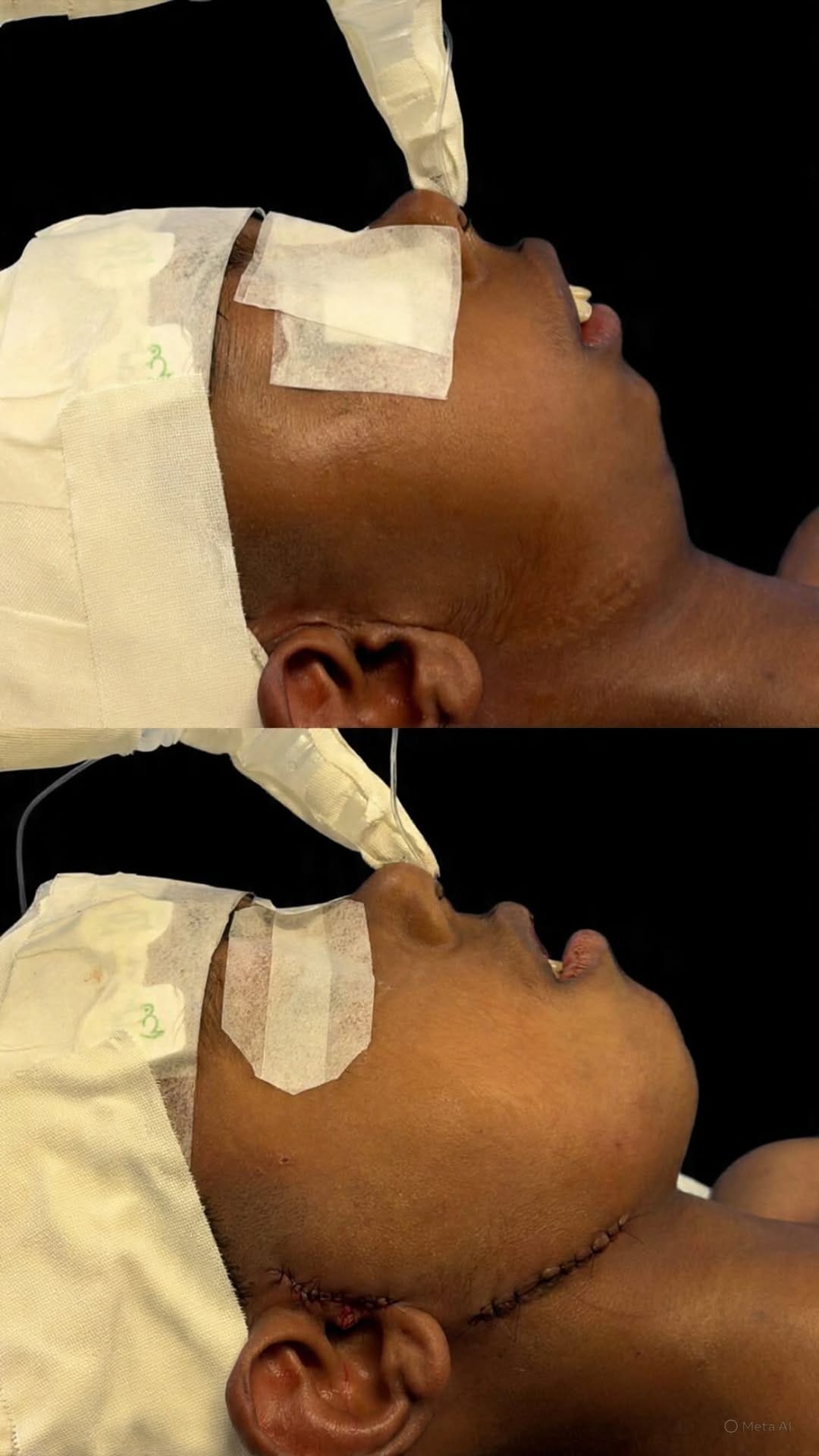 Post 6 by Dr. Luis Gustavo Paiva | Cirurgião Bucomaxilofacial em Goiânia on Instagram (video)