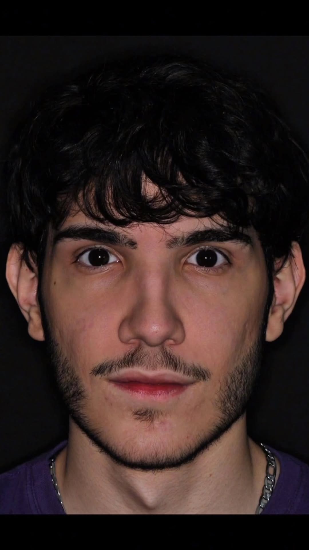 Post 8 by Dr. Luis Gustavo Paiva | Cirurgião Bucomaxilofacial em Goiânia on Instagram (video)