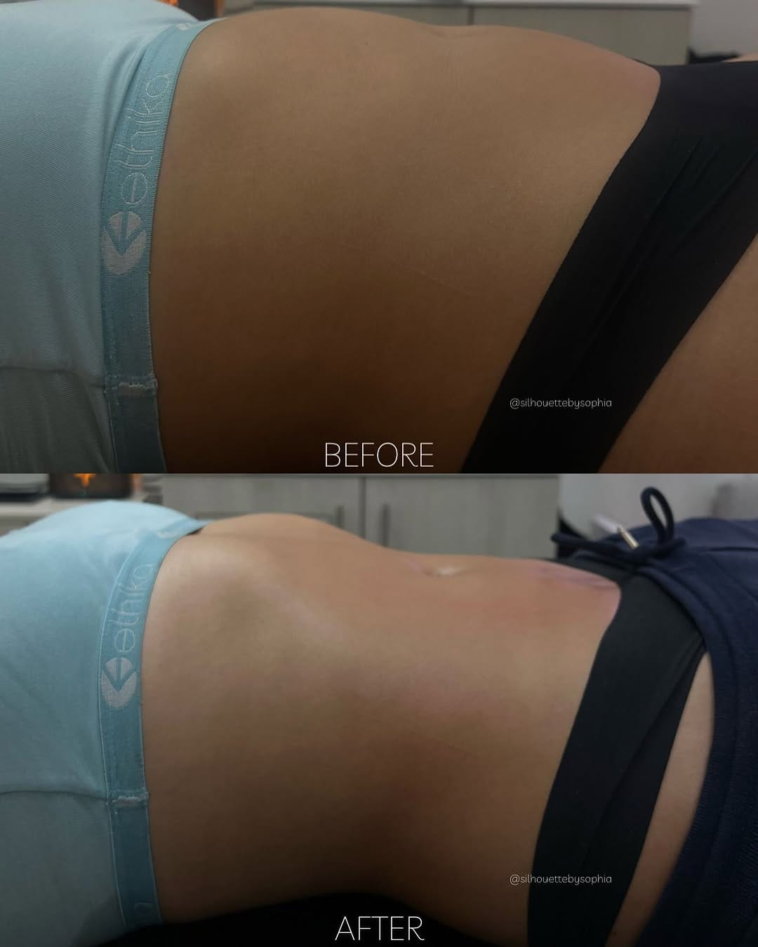 Post 3 by by Sophia / Brazilian Lymphatic & Body Sculpting Expert | LA on Instagram (image)