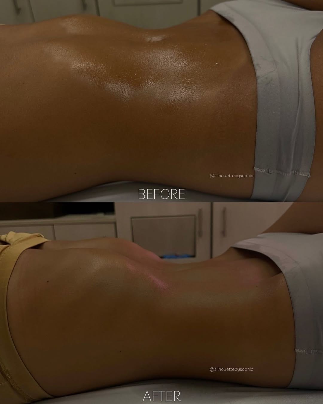 Post 6 by by Sophia / Brazilian Lymphatic & Body Sculpting Expert | LA on Instagram (image)