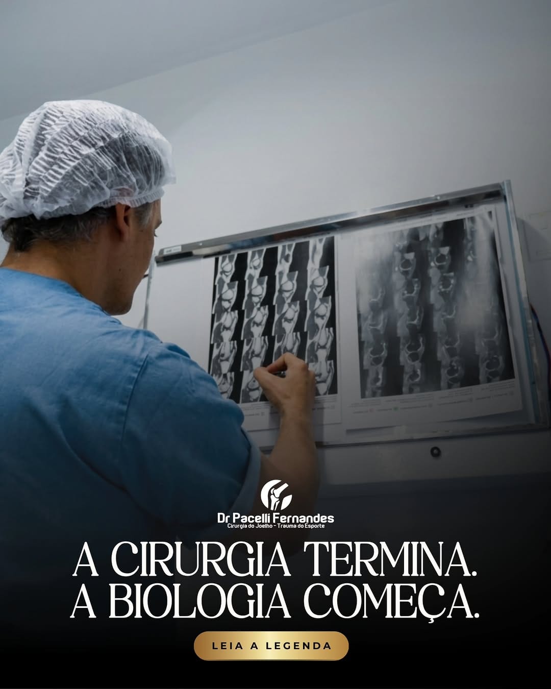 Post 6 by Dr. Pacelli Fernandes           MEDICINA DO ESPORTE on Instagram (image)