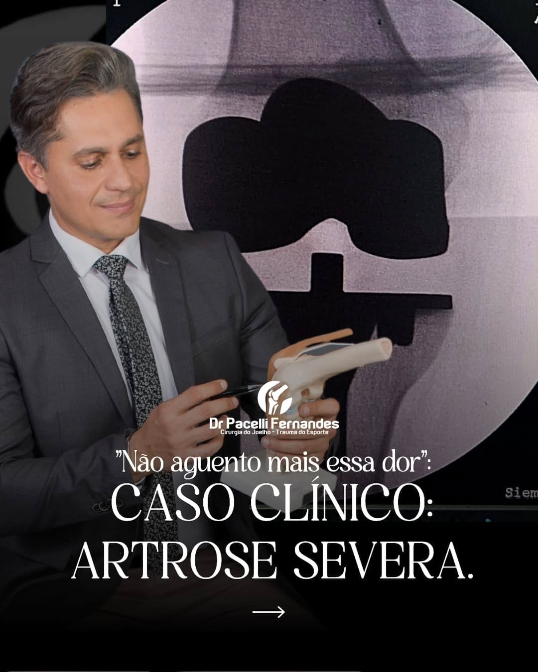 Post 7 by Dr. Pacelli Fernandes           MEDICINA DO ESPORTE on Instagram (carousel)