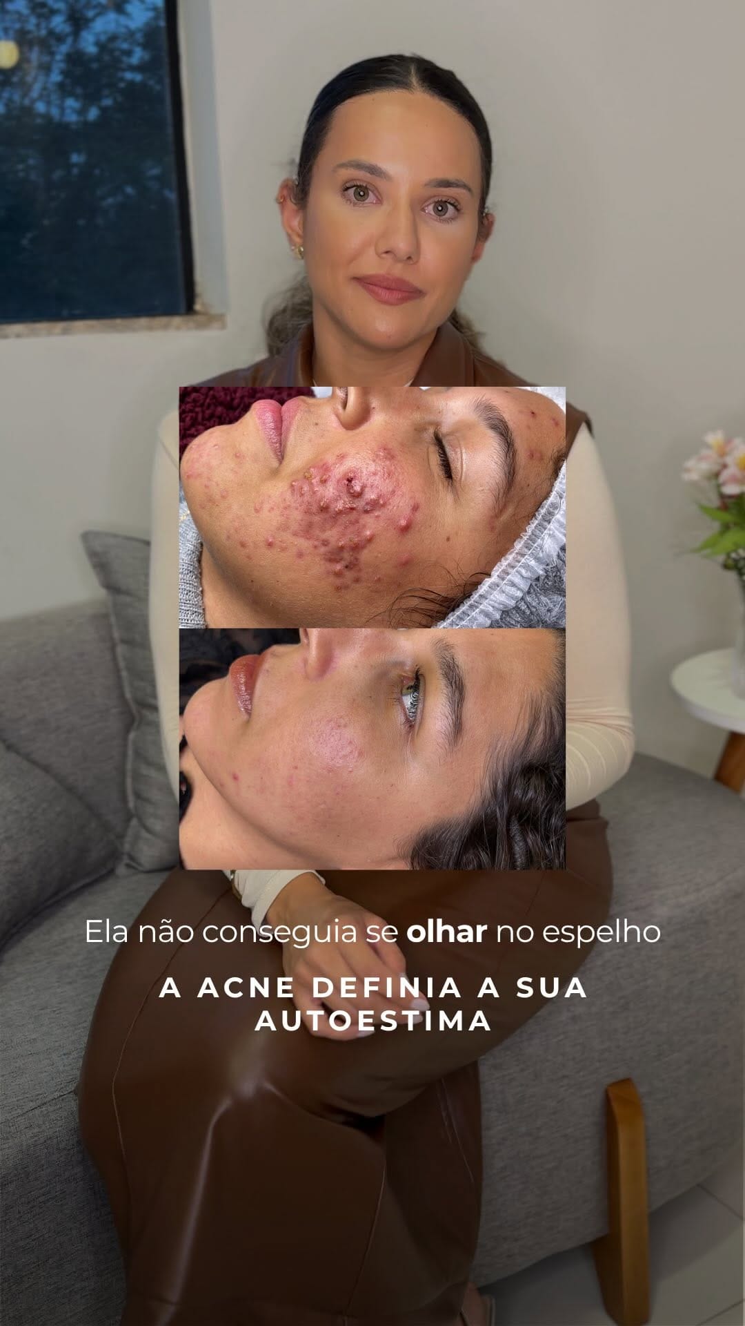 Post 2 by Fernanda Novaes | ESTETICISTA | ACNE / REJUVENESCIMENTO on Instagram (video)