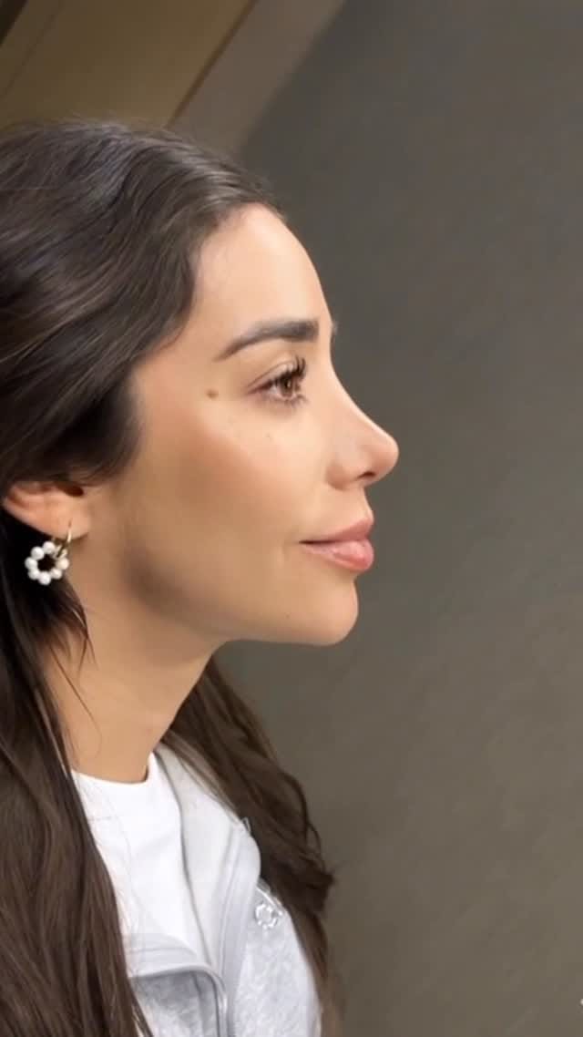 Post 6 by Dr. René Gucon | Dermatología Artística on Instagram (video)