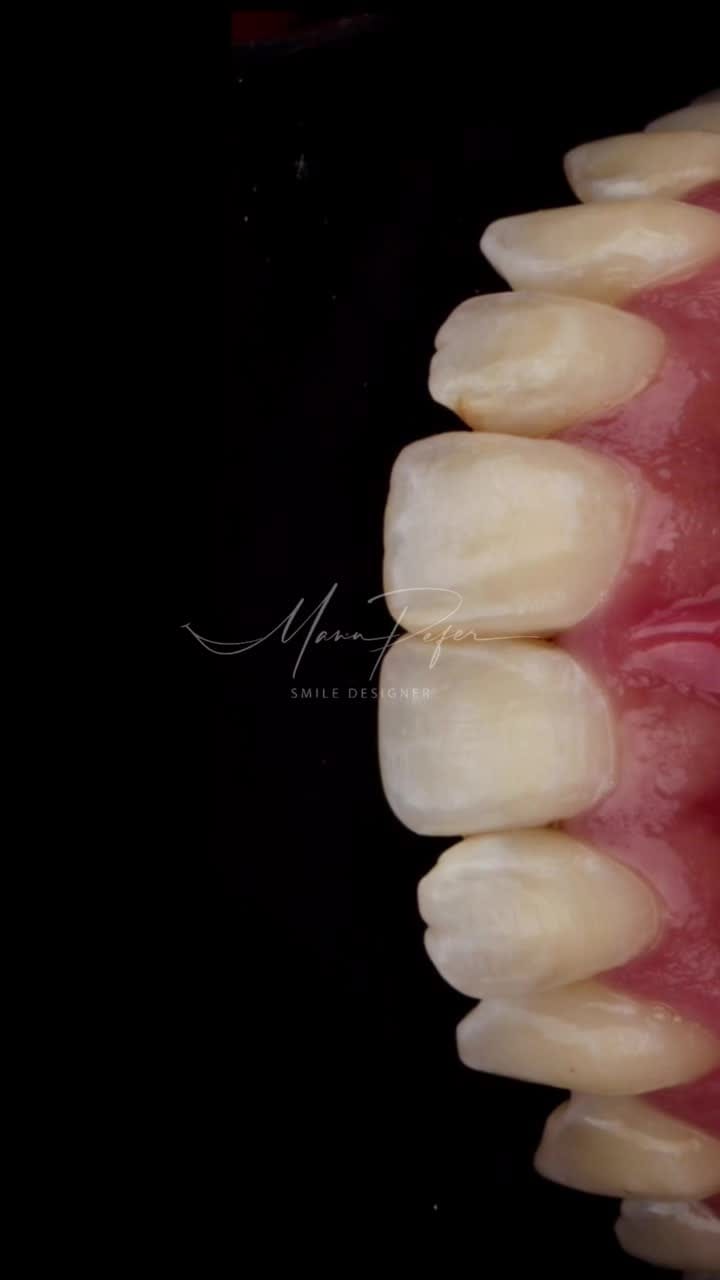 Post 7 by Manuel Alejandro Fernandez Perez on Instagram (video)