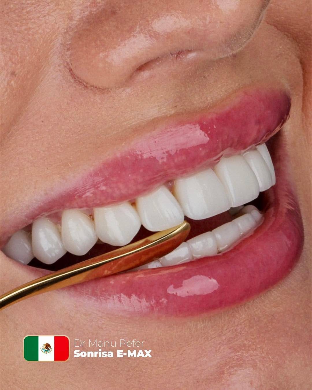 Post 3 by Manuel Alejandro Fernandez Perez on Instagram (image)