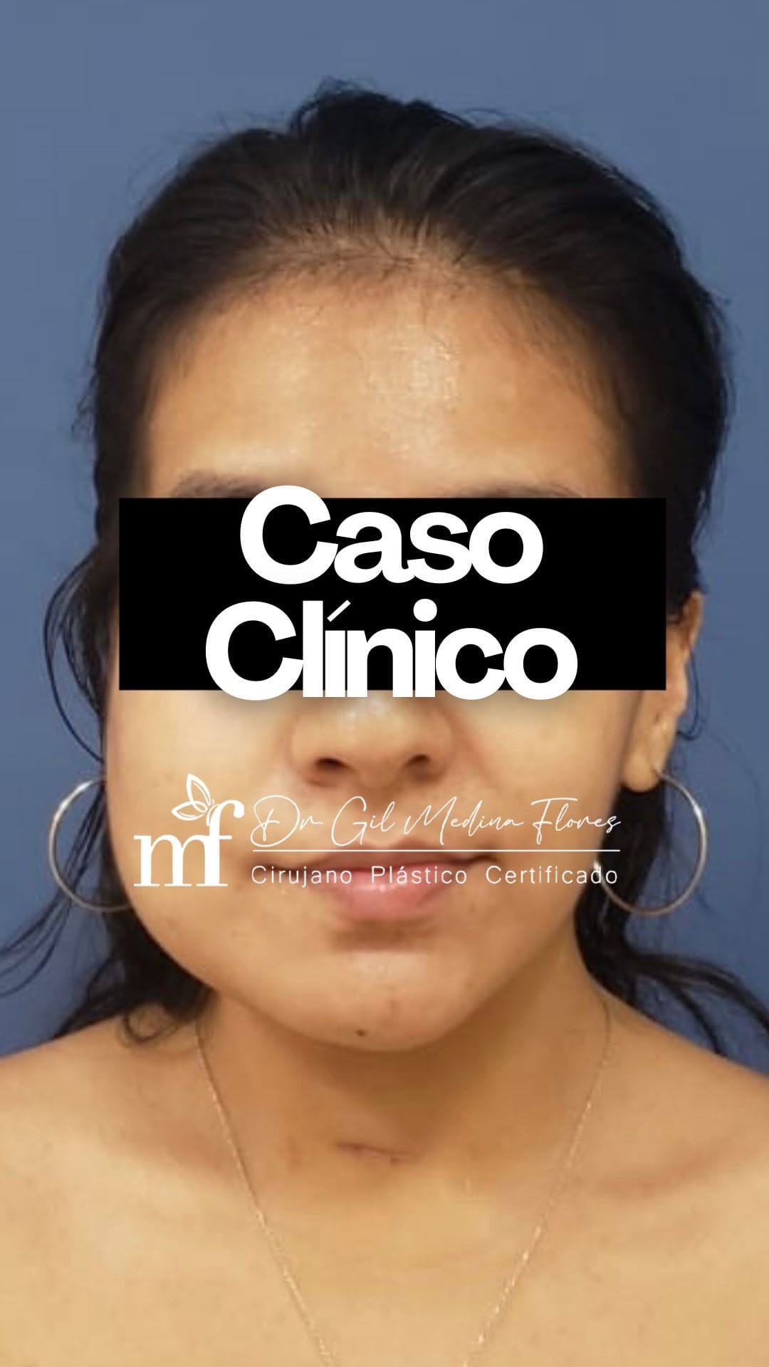 Post 5 by Dr. Gilberto Medina on Instagram (video)
