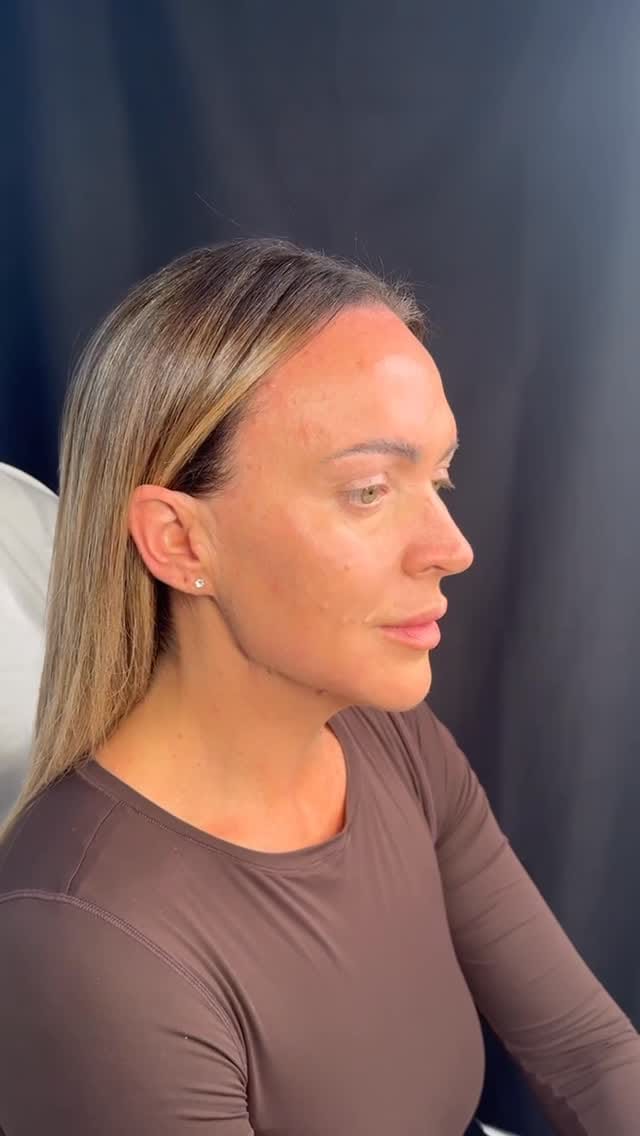Post 8 by Natalie Page Aesthetics Academy on Instagram (video)