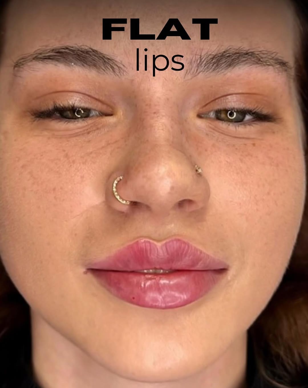 Post 7 by Natalie Page Aesthetics Academy on Instagram (image)