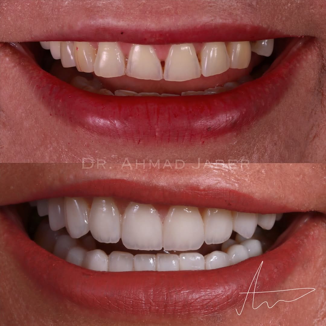 Post 4 by Dr. Ahmad Jaber on Instagram (image)