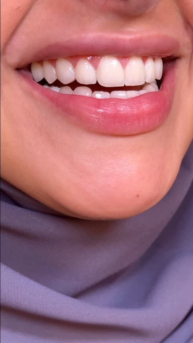 Post 5 by Dr. Ahmad Jaber on Instagram (video)