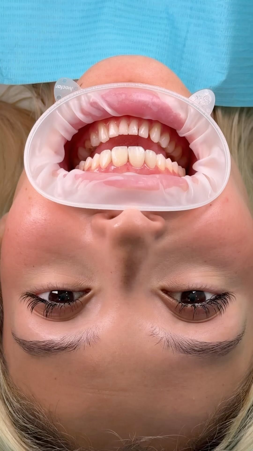 Post 8 by Dr. Ahmad Jaber on Instagram (video)