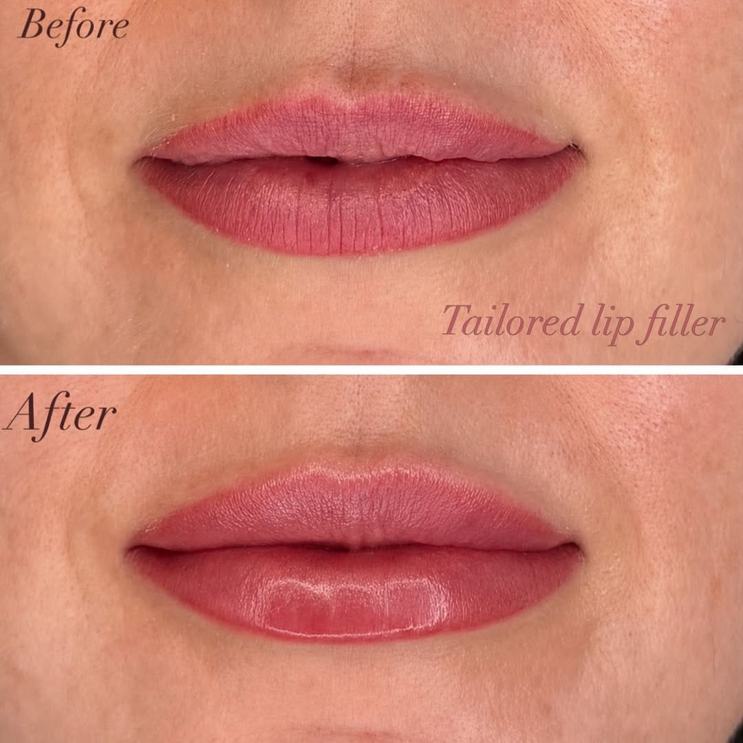 Post 5 by Dr. Sheeral Shah | Skincare & Aesthetics on Instagram (image)