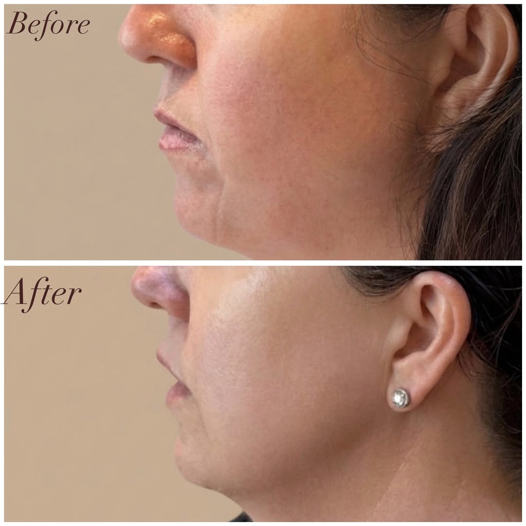 Post 2 by Dr. Sheeral Shah | Skincare & Aesthetics on Instagram (image)